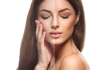 Woman Before And After Tan — Beautician in Coffs Harbour, NSW