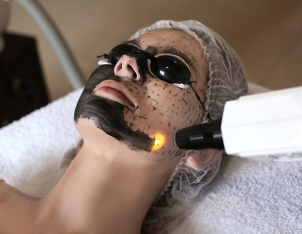 Woman Undergoing Carbon Peeling Treatment — Beautician in Coffs Harbour, NSW