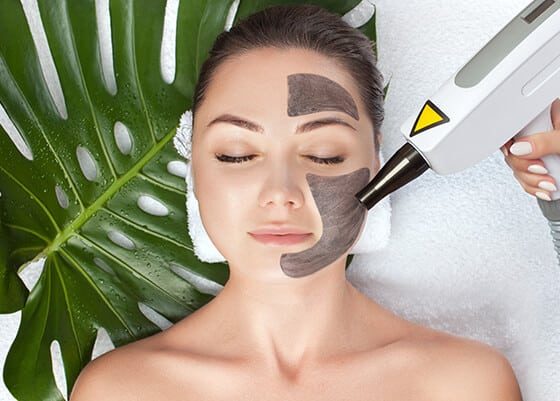 Carbon Face Peeling Procedure — Beautician in Coffs Harbour, NSW