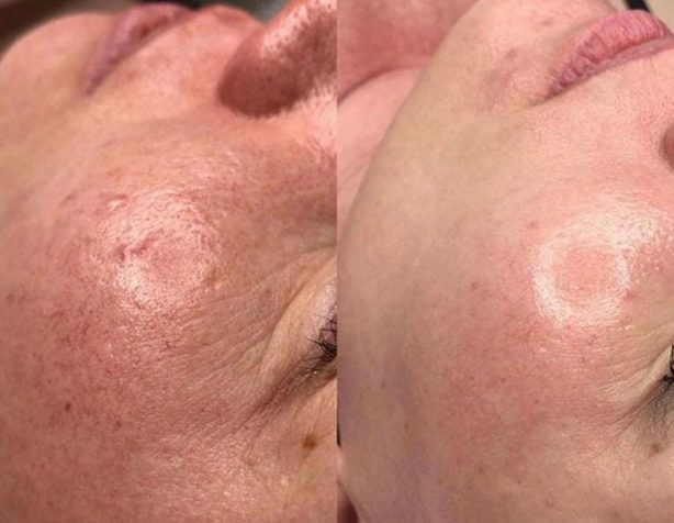 skn-needlink-gallery-image-(1)