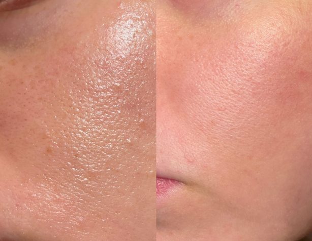 skn-needlink-gallery-image-(2)