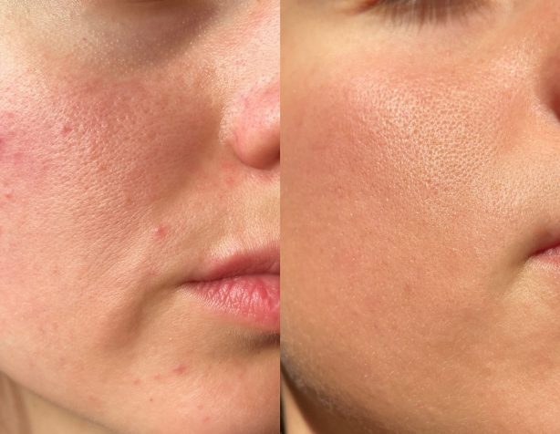 skn-needlink-gallery-image-(3)