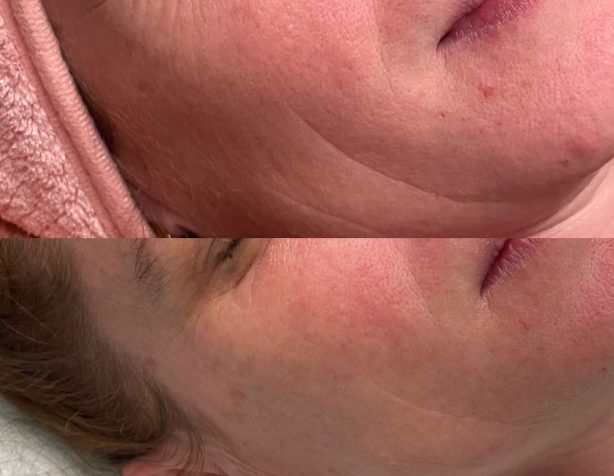 skn-needlink-gallery-image-(4)